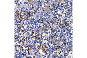Immunohistochemistry of paraffin-embedded rat spleen using STAMBP antibody at dilution of 1:100 (x400 lens). (STAMBP Antikörper)