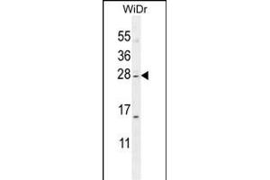 IQCF1 Antibody (N-term) (ABIN655458 and ABIN2844987) western blot analysis in WiDr cell line lysates (35 μg/lane). (IQCF1 Antikörper  (N-Term))