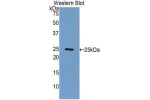 Western blot analysis of the recombinant protein. (FBLN2 Antikörper  (AA 858-1069))