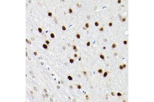 Immunohistochemistry of paraffin-embedded rat brain using S Rabbit pAb (ABIN6130296, ABIN6147396, ABIN6147398 and ABIN6221485) at dilution of 1:200 (40x lens). (SATB1 Antikörper  (AA 484-763))