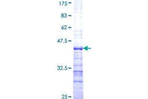 Image no. 1 for Ribosomal Protein L13 (RPL13) (AA 112-211) protein (GST tag) (ABIN1318546)