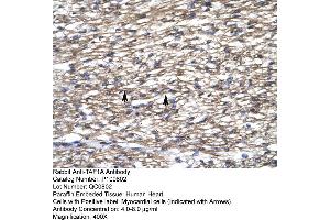 Immunohistochemistry (IHC) image for anti-TATA Box Binding Protein (TBP)-Associated Factor, RNA Polymerase I, A, 48kDa (TAF1A) (C-Term) antibody (ABIN2792590)