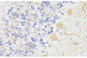 Immunohistochemistry of paraffin-embedded Rat cerebellum using ELP3 Polyclonal Antibody at dilution of 1:100 (40x lens).