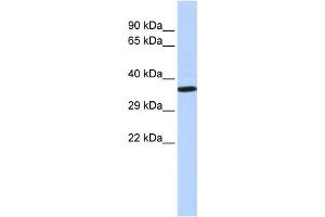 WB Suggested Anti-NKX2-2 Antibody Titration:  0. (Nkx2-2 Antikörper  (N-Term))