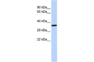 WB Suggested Anti-NKX2-2 Antibody Titration:  0.