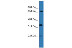 WB Suggested Anti-DOK4 Antibody Titration: 0. (DOK4 Antikörper  (N-Term))