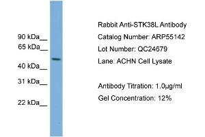 WB Suggested Anti-STK38L  Antibody Titration: 0. (STK38L Antikörper  (Middle Region))