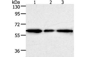 Western Blot analysis of Human liver cancer tissue, hela and 293T cell using AKR1A1 Polyclonal Antibody at dilution of 1:500 (AKR1A1 Antikörper)