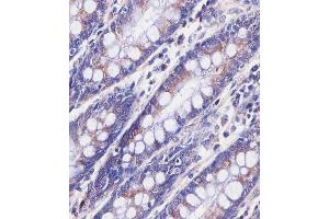 Immunohistochemistry (Paraffin-embedded Sections) (IHC (p)) image for anti-Poly(A) Binding Protein, Cytoplasmic 3 (PABPC3) (AA 84-117) antibody (ABIN6243775)