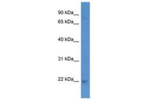 Image no. 1 for anti-Partner of Y14 and mago (WIBG) (C-Term) antibody (ABIN6746847) (PYM Antikörper  (C-Term))