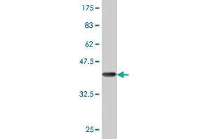 Western Blot detection against Immunogen (36. (DCP1A Antikörper  (AA 186-285))