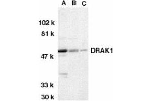 Image no. 1 for anti-serine/threonine Kinase 17a (STK17A) (AA 5-19) antibody (ABIN203102) (STK17A Antikörper  (AA 5-19))