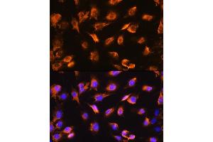 Immunofluorescence analysis of C6 cells using alpha Sarcoglycan (alpha Sarcoglycan (SGCA)) Rabbit pAb (ABIN1682687, ABIN5664644, ABIN5664646 and ABIN6220497) at dilution of 1:100. (SGCA Antikörper  (AA 60-290))