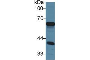 Detection of AFP in Mouse Cerebrum lysate using Polyclonal Antibody to Alpha-Fetoprotein (AFP) (alpha Fetoprotein Antikörper  (AA 409-611))