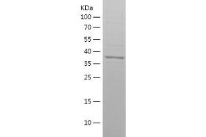 Western Blotting (WB) image for Ras Homolog Gene Family, Member A (RHOA) (AA 61-193) protein (His-IF2DI Tag) (ABIN7124783)