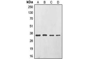Western blot analysis of CD326 expression in A431 (A), SW480 (B), HepG2 (C), Caco2 (D) whole cell lysates.