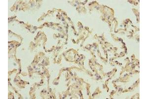 Immunohistochemistry of paraffin-embedded human lung tissue using ABIN7142727 at dilution of 1:100 (RPLP2 Antikörper  (AA 1-115))