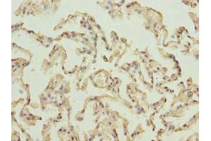 Immunohistochemistry of paraffin-embedded human lung tissue using ABIN7142727 at dilution of 1:100