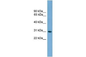 Western Blotting (WB) image for anti-Major Histocompatibility Complex, Class II, DQ alpha 2 (HLA-DQA2) (N-Term) antibody (ABIN2783759)