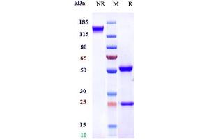Anti-FGFR4 / CD334 Reference Antibody (U3-1784) on SDS-PAGE under reducing (R) condition. (Rekombinanter FGFR4 Antikörper)