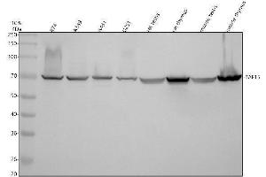 Western blot analysis of TAF15 using anti-TAF15 antibody (ABIN7825913).