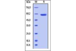 SDS-PAGE (SDS) image for V-Set and Immunoglobulin Domain Containing 8 (VSIG8) (AA 22-263) protein (Fc Tag,AVI tag,Biotin) (ABIN5526638)