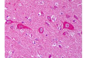 Anti-AHSA1 / AHA1 antibody IHC of human brain, cortex neurons. (AHSA1 Antikörper)