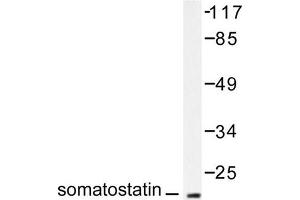 Image no. 2 for anti-Somatostatin (SST) antibody (ABIN271820) (Somatostatin Antikörper)