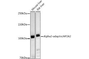 Western blot analysis of extracts of various cell lines, using Alph-adaptin/ antibody (ABIN6130980, ABIN6136955, ABIN6136957 and ABIN6221039) at 1:1000 dilution. (AP2A2 Antikörper  (AA 590-939))