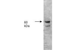 Image no. 2 for anti-Intestinal Alkaline Phosphatase (ALPI) antibody (ABIN303053)