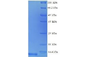 Chemokine (C-C Motif) Ligand 3 (CCL3) (AA 24-92), (full length) protein (His tag) (CCL3 Protein (AA 24-92, full length) (His tag))