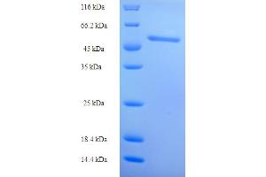 SDS-PAGE (SDS) image for Retinol Dehydrogenase 12 (All-Trans/9-Cis/11-Cis) (RDH12) (AA 1-316), (full length) protein (His-SUMO Tag) (ABIN5711610)