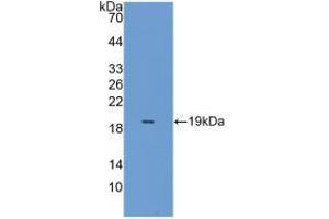Western blot analysis of the recombinant protein. (Peroxiredoxin 5 Antikörper  (AA 49-210))