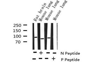 Western blot analysis of Phospho-p95/NBS1 (Ser343) expression in various lysates (Nibrin Antikörper  (pSer343))