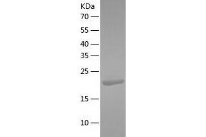 BCL7C Protein (AA 1-217) (His tag)