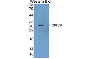 Western blot analysis of the recombinant protein. (KPNA3 Antikörper  (AA 3-220))