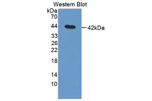 Western blot analysis of the recombinant protein. (C3 Antikörper  (AA 965-1303))