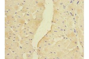 Immunohistochemistry of paraffin-embedded human heart tissue using ABIN7142007 at dilution of 1:100 (PDK3 Antikörper  (AA 137-406))