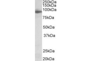 Western Blotting (WB) image for anti-Neuroligin 4 (NLGN4) (Internal Region) antibody (ABIN2465126) (Neuroligin 4 Antikörper  (Internal Region))