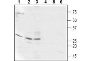 Western blot analysis of  Human ARPE-19 retinal epithelium (lanes 1 and 4), mouse heart (lanes 2 and 5), and rat heart (lanes 3 and 6) lysates: - 1-3. (CABP2 Antikörper  (Intracellular, N-Term))