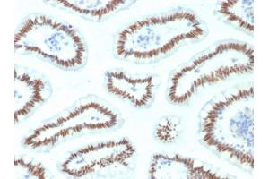 Immunohistochemistry (IHC) image for anti-HNF1 Homeobox A (HNF1A) (AA 214-339) antibody (ABIN6940684)
