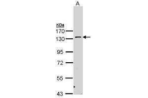 WB Image Sample (30 ug of whole cell lysate) A: H1299 7. (PKN2 Antikörper)