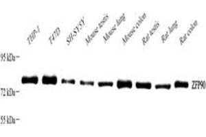 Western blot analysis of ZFP90 ABIN7076275),at dilution of 1: 2000,Lane 1: THP-1 cell lysate,Lane 2: T47D cell lysate,Lane 3: SH-SY5Y cell lysate,Lane 4: Mouse testis tissue lysate,Lane 5: Mouse lung tissue lysate,Lane 6: Mouse colon tissue lysate,Lane 7: Rat testis tissue lysate,Lane 8: Rat lung tissue lysate,Lane 9: Rat colon tissue lysate (ZNF90 Antikörper)
