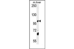 Western blot analysis of DHTKD1 Antibody  in mouse liver tissue lysates (35ug/lane). (DHTKD1 Antikörper  (Middle Region))