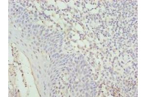 Immunohistochemistry of paraffin-embedded human tonsil tissue using ABIN7149090 at dilution of 1:100 (CYBC1 (AA 43-187) Antikörper)