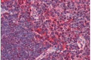 Human Thymus (formalin-fixed, paraffin-embedded) stained with CXCR6 antibody ABIN351436 at 2. (CXCR6 Antikörper  (N-Term))