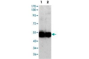 Western blot analysis using VCAM1 monoclonal antobody, clone 6G9  against HUVEC (1) and EC (2) cell lysate. (VCAM1 Antikörper)