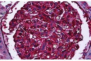 Human Kidney, Glomeruli: Formalin-Fixed, Paraffin-Embedded (FFPE) (Myosin 9 Antikörper)
