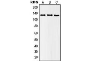 Western blot analysis of Histone Deacetylase 5 (pS498) expression in HEK293T LPS-treated (A), Raw264. (HDAC5 Antikörper  (pSer498))