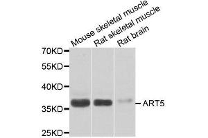 Western blot analysis of extracts of various cell lines, using ART5 antibody. (ART5 Antikörper  (AA 23-200))